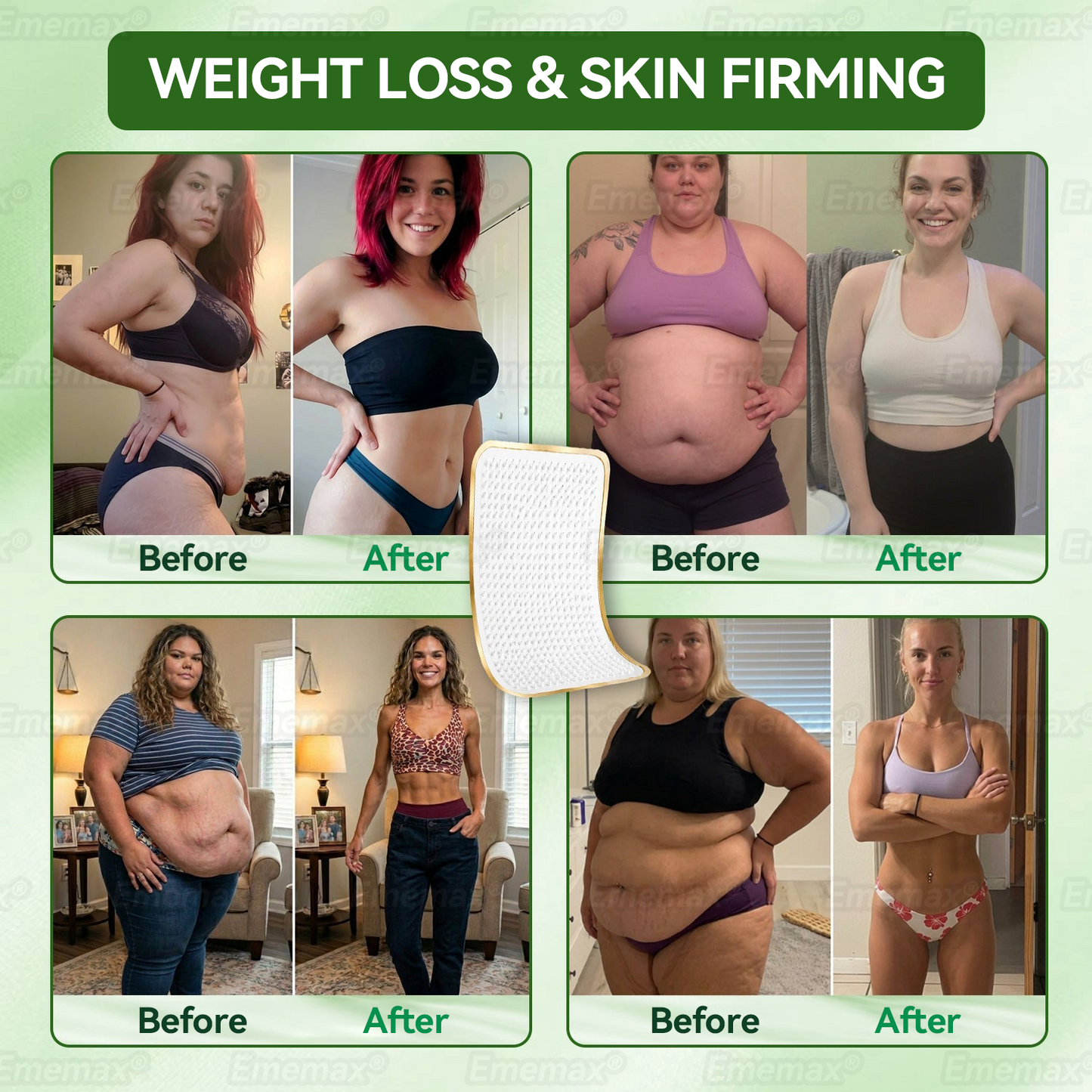 ✨👌[𝟐𝟎𝟐𝟔 𝐍𝐞𝐰 & 𝐔𝐩𝐠𝐫𝐚𝐝𝐞𝐝: 𝟖𝟎% 𝐎𝐅𝐅] ✅ 𝑬𝒎𝒆𝒎𝒂𝒙® 𝑳𝒚𝒎𝒑𝒉𝒂𝒕𝒊𝒄 𝑫𝒓𝒂𝒊𝒏𝒂𝒈𝒆 𝑺𝒍𝒊𝒎𝒎𝒊𝒏𝒈 𝑵𝒂𝒏𝒐 𝑴𝒊𝒄𝒓𝒐𝒏𝒆𝒆𝒅𝒍𝒆 𝑷𝒂𝒕𝒄𝒉 — 𝐏𝐥𝐮𝐬 𝐉𝐨𝐢𝐧𝐭 𝐑𝐞𝐥𝐢𝐞𝐟, 𝐁𝐞𝐭𝐭𝐞𝐫 𝐒𝐥𝐞𝐞𝐩 & 𝐌𝐞𝐧𝐭𝐚𝐥 𝐂𝐥𝐚𝐫𝐢𝐭𝐲.