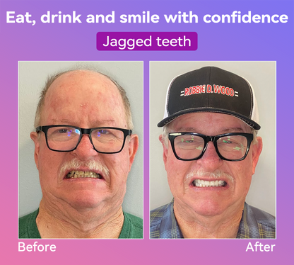 𝐉𝐚𝐬𝐬𝐞𝐞𝐦® Latest Premium Comfort Dentures💖 (High-End Dentures, Easy to Wear - Limited Time 70% Discount)🔥