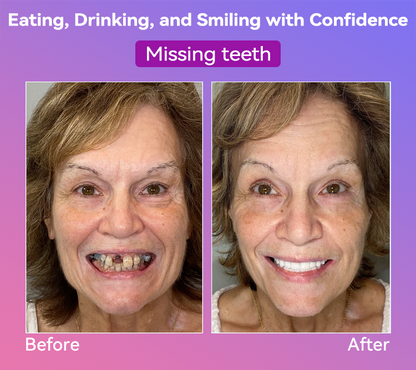 𝐉𝐚𝐬𝐬𝐞𝐞𝐦® Latest Premium Comfort Dentures💖 (High-End Dentures, Easy to Wear - Limited Time 70% Discount)🔥