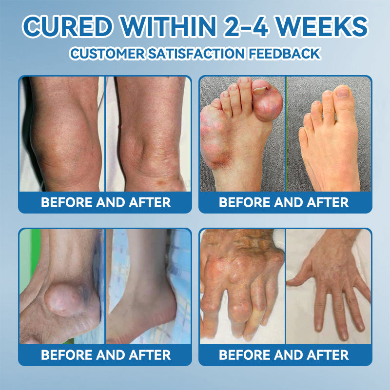 𝐎𝐟𝐟𝐢𝐜𝐢𝐚𝐥 𝐬𝐭𝐨𝐫𝐞 💧|𝑷𝐢𝐜𝐝𝐨® 𝑩𝐏𝐂-𝟏𝟓𝟕 𝐉𝐨𝐢𝐧𝐭 𝐇𝐞𝐚𝐥𝐢𝐧𝐠 𝐂𝐫𝐞𝐚𝐦🦴𝐓𝐫𝐞𝐚𝐭𝐬 𝐀𝐫𝐭𝐡𝐫𝐢𝐭𝐢𝐬, 𝐍𝐞𝐮𝐫𝐨𝐩𝐚𝐭𝐡𝐲, 𝐑𝐡𝐞𝐮𝐦𝐚𝐭𝐢𝐬𝐦, 𝐒𝐩𝐨𝐫𝐭𝐬 𝐈𝐧𝐣𝐮𝐫𝐢𝐞𝐬 & 𝐌𝐨𝐫𝐞