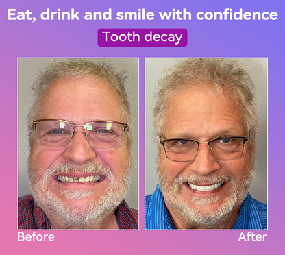 𝐉𝐚𝐬𝐬𝐞𝐞𝐦® Latest Premium Comfort Dentures💖 (High-End Dentures, Easy to Wear - Limited Time 70% Discount)🔥