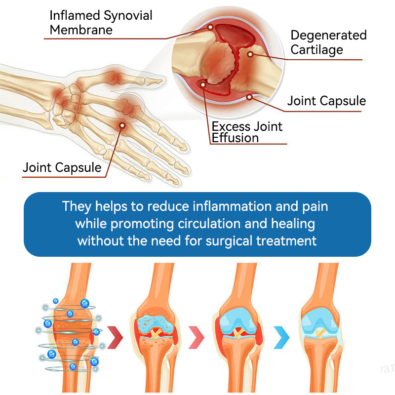 𝐎𝐟𝐟𝐢𝐜𝐢𝐚𝐥 𝐬𝐭𝐨𝐫𝐞 👩‍⚕️🎁|𝑷𝐢𝐜𝐝𝐨® 𝑩𝐏𝐂-𝟏𝟓𝟕 𝐉𝐨𝐢𝐧𝐭 𝐇𝐞𝐚𝐥𝐢𝐧𝐠 𝐂𝐫𝐞𝐚𝐦🦴𝐓𝐫𝐞𝐚𝐭𝐬 𝐀𝐫𝐭𝐡𝐫𝐢𝐭𝐢𝐬, 𝐍𝐞𝐮𝐫𝐨𝐩𝐚𝐭𝐡𝐲, 𝐑𝐡𝐞𝐮𝐦𝐚𝐭𝐢𝐬𝐦, 𝐒𝐩𝐨𝐫𝐭𝐬 𝐈𝐧𝐣𝐮𝐫𝐢𝐞𝐬 & 𝐌𝐨𝐫𝐞