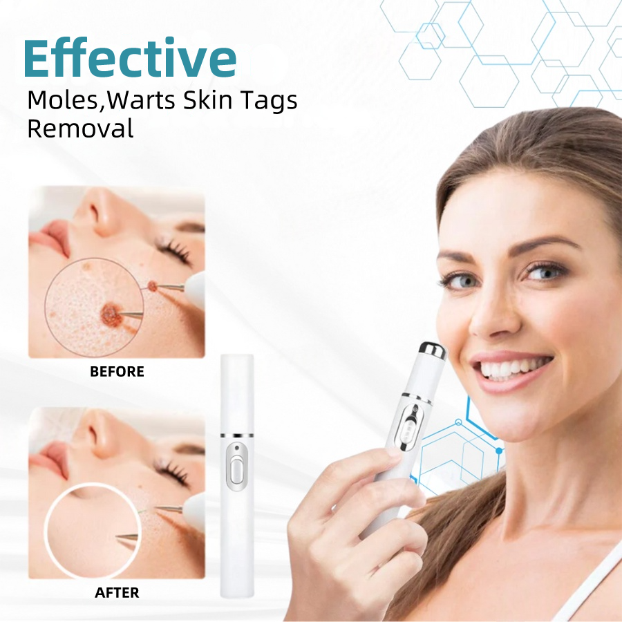 𝐉𝐚𝐬𝐬𝐞𝐞𝐦® Medical-Grade Laser Pen 💕 (Powered by CO₂ laser technology – effectively removes moles, warts, skin tags, pigmentation spots, and other skin imperfections)🏆