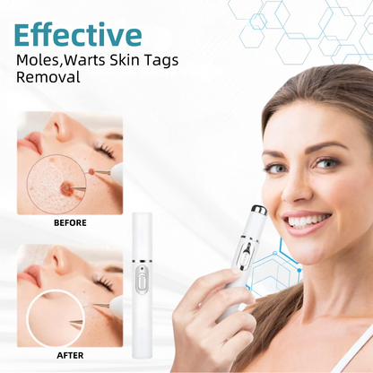 𝐉𝐚𝐬𝐬𝐞𝐞𝐦® Medical-Grade Laser Pen 💕 (Powered by CO₂ laser technology – effectively removes moles, warts, skin tags, pigmentation spots, and other skin imperfections)🏆
