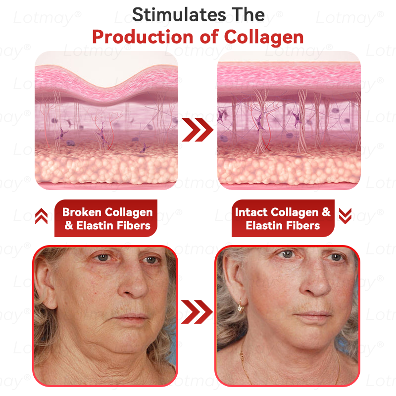 Made in USA☘️ 𝐿𝑜𝑡𝑚𝑎𝑦® 𝑁𝑀𝑁 𝑁𝐴𝐷+  𝐵𝑜𝑜𝑠𝑡 𝐹𝑖𝑟𝑚𝑖𝑛𝑔 & 𝐴𝑛𝑡𝑖-𝑎𝑔𝑖𝑛𝑔 𝑂𝑟𝑎𝑙 𝐿𝑖𝑞𝑢𝑖𝑑