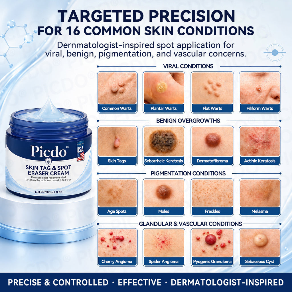 𝐏𝐢𝐜𝐝𝐨® 7-𝐃𝐚𝐲 𝐒𝐤𝐢𝐧 𝐓𝐚𝐠 & 𝐒𝐩𝐨𝐭 𝐄𝐫𝐚𝐬𝐞𝐫 𝐂𝐫𝐞𝐚𝐦🩵 (Zero Pain, Zero 𝐒𝐜𝐚𝐫𝐬 Formula) 💪