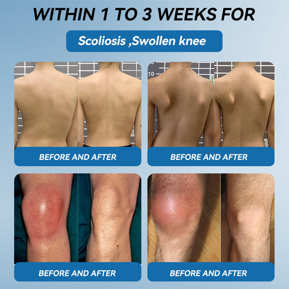 𝐎𝐟𝐟𝐢𝐜𝐢𝐚𝐥 𝐬𝐭𝐨𝐫𝐞 👩‍⚕️🎁|𝑷𝐢𝐜𝐝𝐨® 𝑩𝐏𝐂-𝟏𝟓𝟕 𝐉𝐨𝐢𝐧𝐭 𝐇𝐞𝐚𝐥𝐢𝐧𝐠 𝐂𝐫𝐞𝐚𝐦🦴𝐓𝐫𝐞𝐚𝐭𝐬 𝐀𝐫𝐭𝐡𝐫𝐢𝐭𝐢𝐬, 𝐍𝐞𝐮𝐫𝐨𝐩𝐚𝐭𝐡𝐲, 𝐑𝐡𝐞𝐮𝐦𝐚𝐭𝐢𝐬𝐦, 𝐒𝐩𝐨𝐫𝐭𝐬 𝐈𝐧𝐣𝐮𝐫𝐢𝐞𝐬 & 𝐌𝐨𝐫𝐞