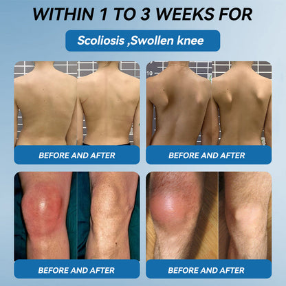 𝐎𝐟𝐟𝐢𝐜𝐢𝐚𝐥 𝐬𝐭𝐨𝐫𝐞 👩‍⚕️🎁|𝑷𝐢𝐜𝐝𝐨® 𝑩𝐏𝐂-𝟏𝟓𝟕 𝐉𝐨𝐢𝐧𝐭 𝐇𝐞𝐚𝐥𝐢𝐧𝐠 𝐂𝐫𝐞𝐚𝐦🦴𝐓𝐫𝐞𝐚𝐭𝐬 𝐀𝐫𝐭𝐡𝐫𝐢𝐭𝐢𝐬, 𝐍𝐞𝐮𝐫𝐨𝐩𝐚𝐭𝐡𝐲, 𝐑𝐡𝐞𝐮𝐦𝐚𝐭𝐢𝐬𝐦, 𝐒𝐩𝐨𝐫𝐭𝐬 𝐈𝐧𝐣𝐮𝐫𝐢𝐞𝐬 & 𝐌𝐨𝐫𝐞