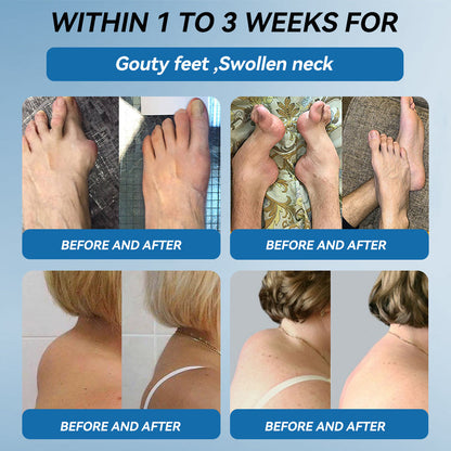 𝐎𝐟𝐟𝐢𝐜𝐢𝐚𝐥 𝐬𝐭𝐨𝐫𝐞 💧|𝑷𝐢𝐜𝐝𝐨® 𝑩𝐏𝐂-𝟏𝟓𝟕 𝐉𝐨𝐢𝐧𝐭 𝐇𝐞𝐚𝐥𝐢𝐧𝐠 𝐂𝐫𝐞𝐚𝐦🦴𝐓𝐫𝐞𝐚𝐭𝐬 𝐀𝐫𝐭𝐡𝐫𝐢𝐭𝐢𝐬, 𝐍𝐞𝐮𝐫𝐨𝐩𝐚𝐭𝐡𝐲, 𝐑𝐡𝐞𝐮𝐦𝐚𝐭𝐢𝐬𝐦, 𝐒𝐩𝐨𝐫𝐭𝐬 𝐈𝐧𝐣𝐮𝐫𝐢𝐞𝐬 & 𝐌𝐨𝐫𝐞