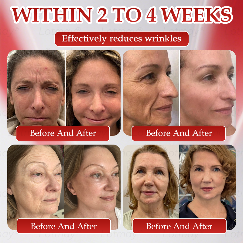 Made in USA☘️ 𝐿𝑜𝑡𝑚𝑎𝑦® 𝑁𝑀𝑁 𝑁𝐴𝐷+  𝐵𝑜𝑜𝑠𝑡 𝐹𝑖𝑟𝑚𝑖𝑛𝑔 & 𝐴𝑛𝑡𝑖-𝑎𝑔𝑖𝑛𝑔 𝑂𝑟𝑎𝑙 𝐿𝑖𝑞𝑢𝑖𝑑