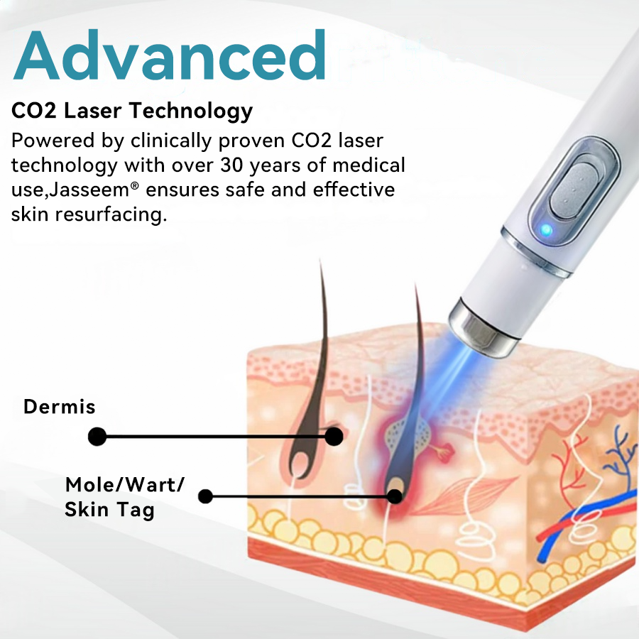 𝐉𝐚𝐬𝐬𝐞𝐞𝐦® Medical-Grade Laser Pen 💕 (Powered by CO₂ laser technology – effectively removes moles, warts, skin tags, pigmentation spots, and other skin imperfections)🏆