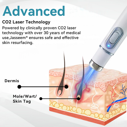 𝐉𝐚𝐬𝐬𝐞𝐞𝐦® Medical-Grade Laser Pen 💕 (Powered by CO₂ laser technology – effectively removes moles, warts, skin tags, pigmentation spots, and other skin imperfections)🏆