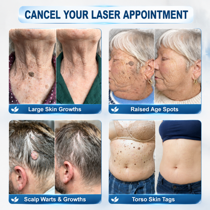 𝐎𝐟𝐟𝐢𝐜𝐢𝐚𝐥 𝐁𝐫𝐚𝐧𝐝 𝐒𝐭𝐨𝐫𝐞 |🧿𝐏i𝐜𝐝o® 7-𝐷𝑎𝑦 𝗧𝐚𝐠 & 𝗦𝗽𝐨𝐭 𝐄𝐫𝒂𝒔𝒆𝒓(Zero Pain, Zero 𝐒𝐜𝐚𝒓𝒔 Rollerball)🌀